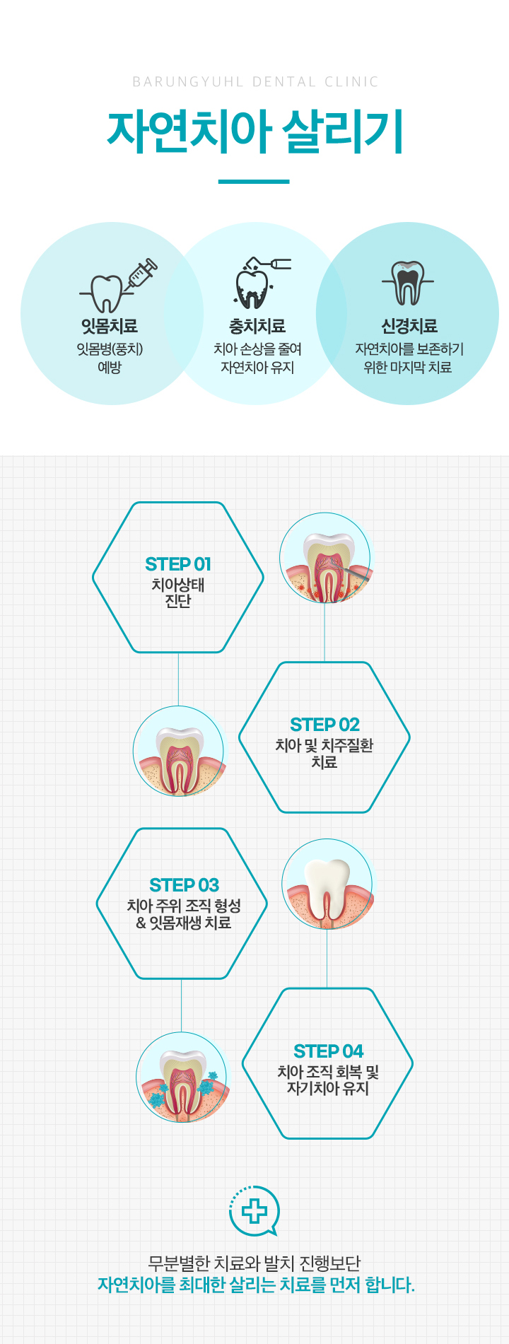 자연치아살리기
