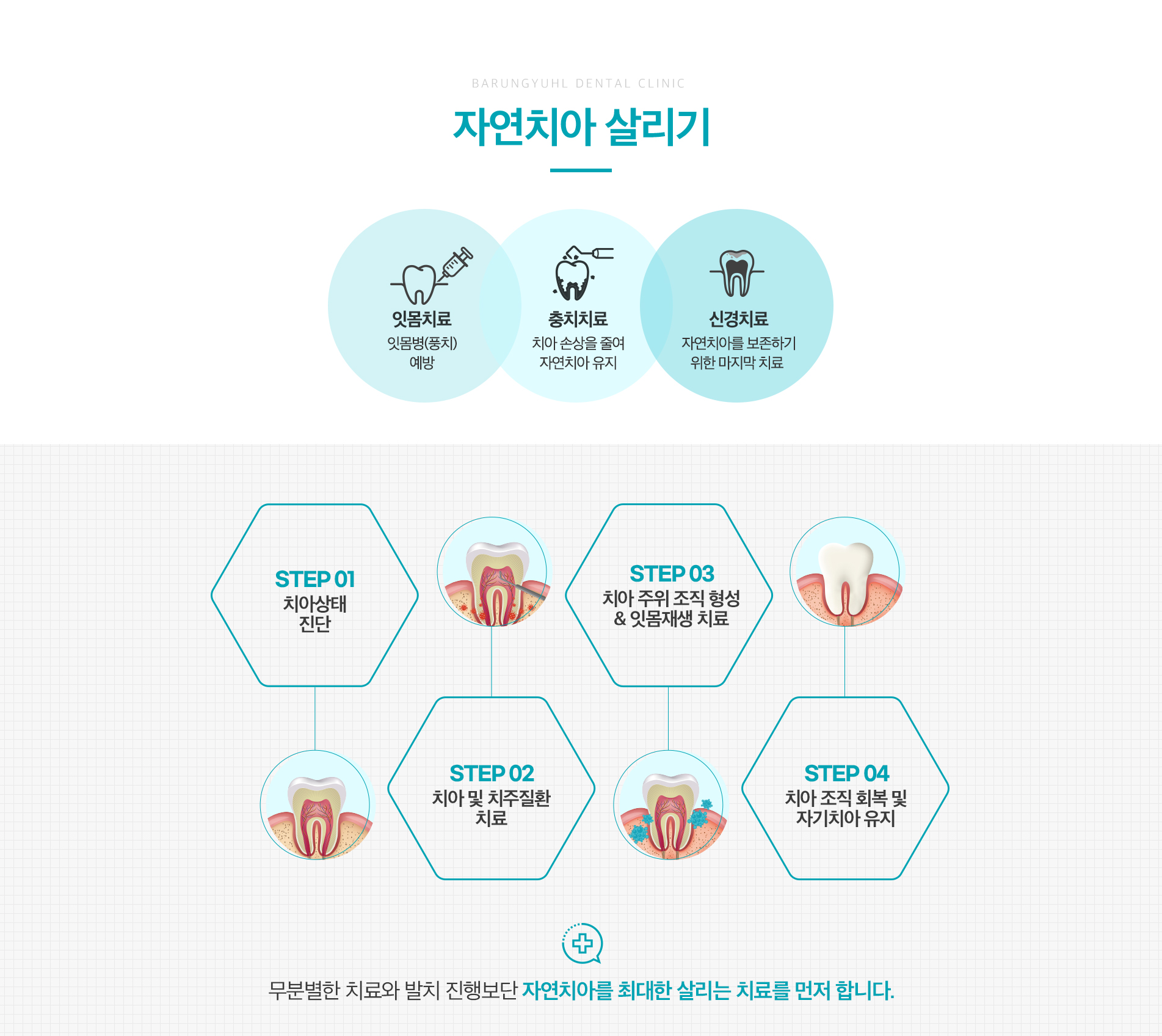 자연치아살리기