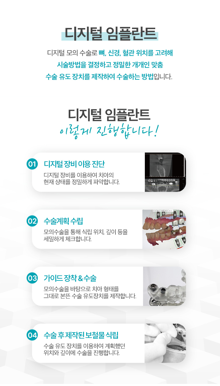 디지털임플란트