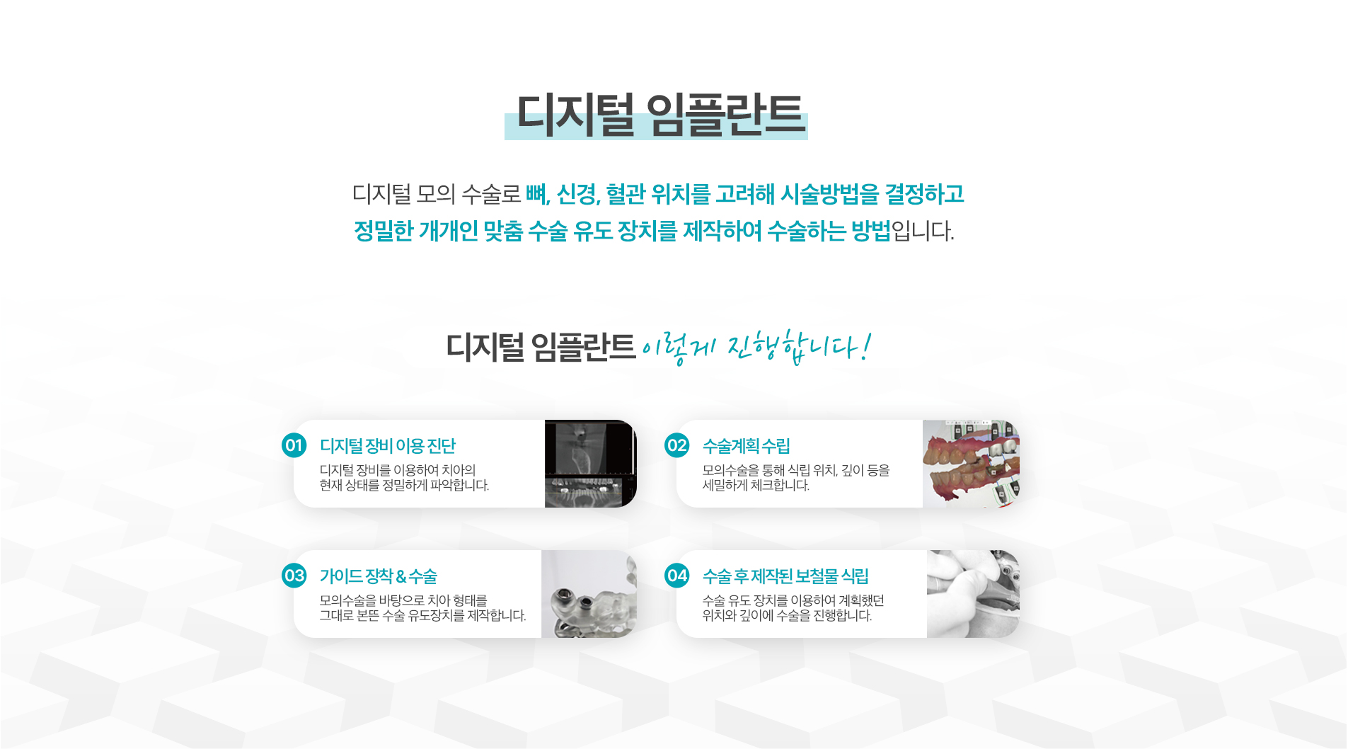 디지털임플란트