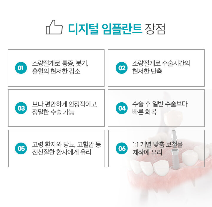 디지털임플란트장점