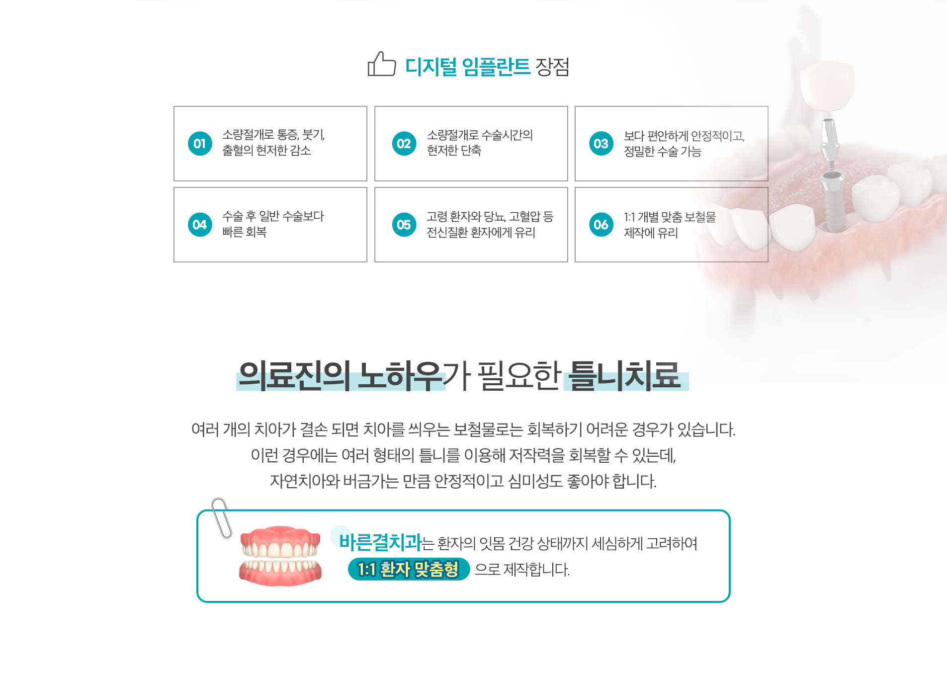 디지털 임플란트 장점