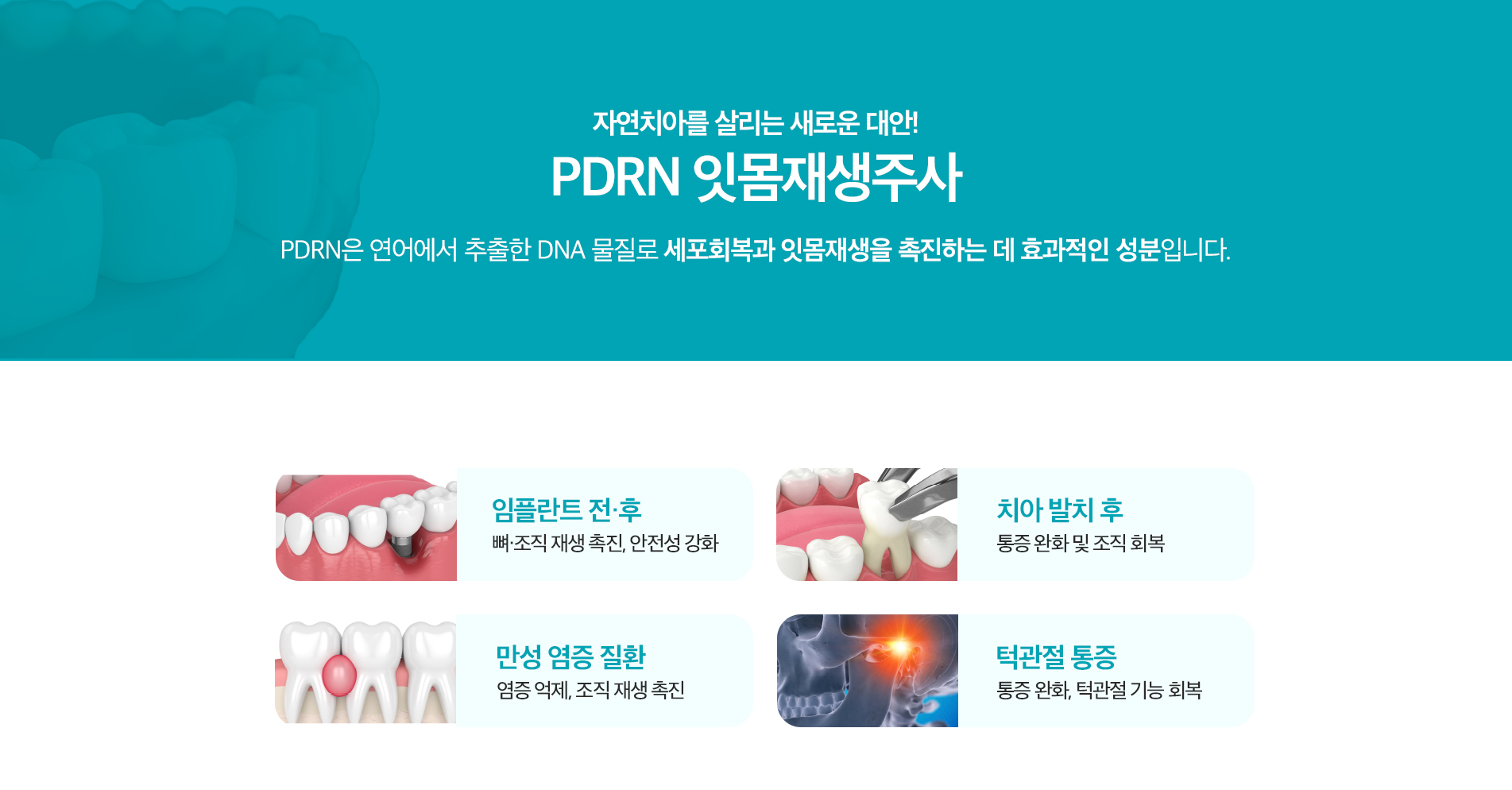 RDRN 잇몸재생주사